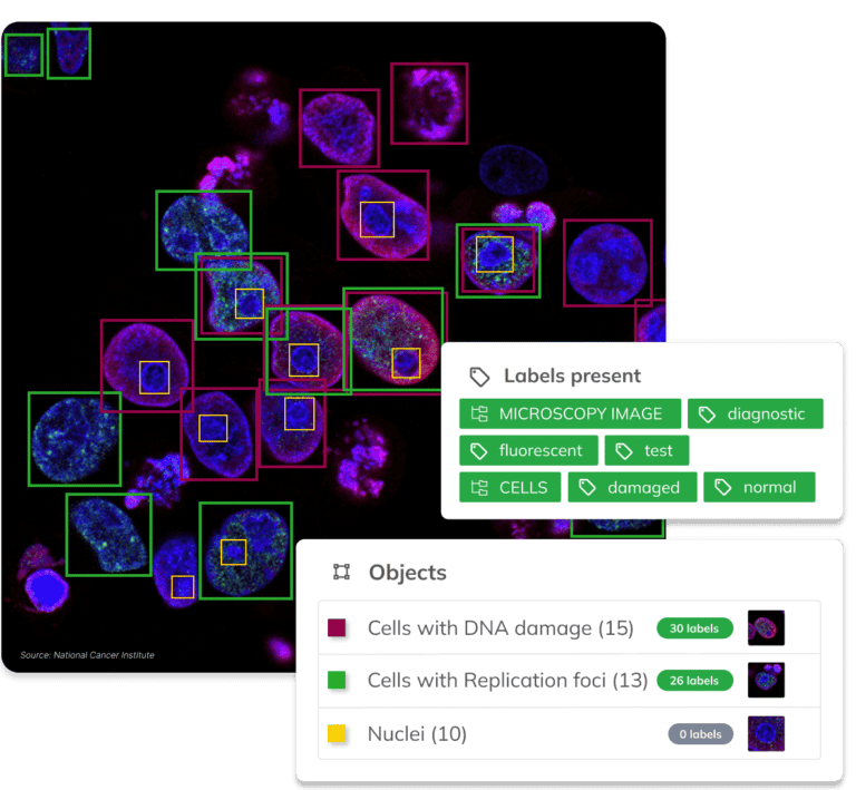 Visual AI by Ximilar can be customized with specific categories, objects, attributes, labels, whole taxonomies or even languages to fit specific use cases. In this case, object detection and image recognition are combined to spot and identify objects in a fluorescent microscopy image.
