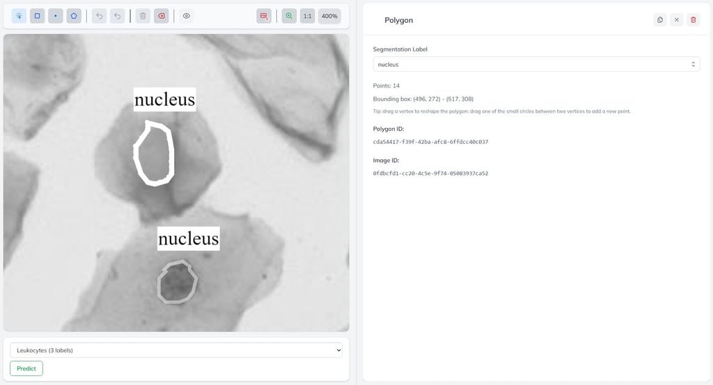 A microscopy image in Annotate. I uploaded this dataset with its polygons already included, but I can still draw new ones or reshape the existing ones here.
