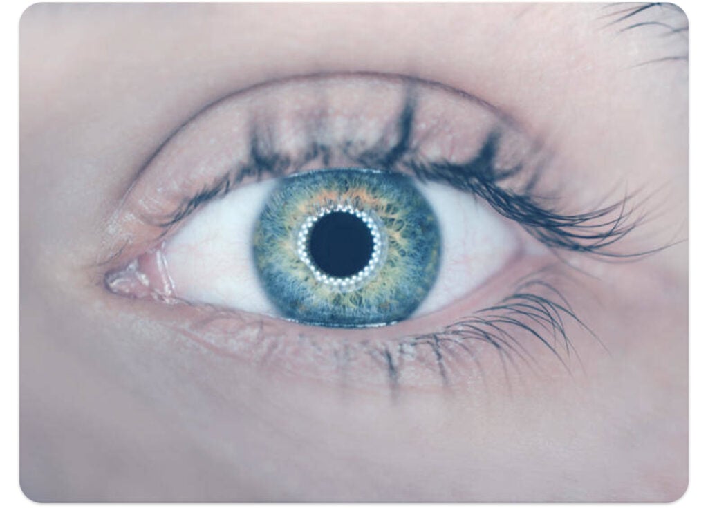 Use Ximilar to create classifiers that can analyze microscope images from biopsies, X-rays, and MRIs. Machine learning can now predict eye diseases, such as diabetic retinopathy, by processing these types of images.