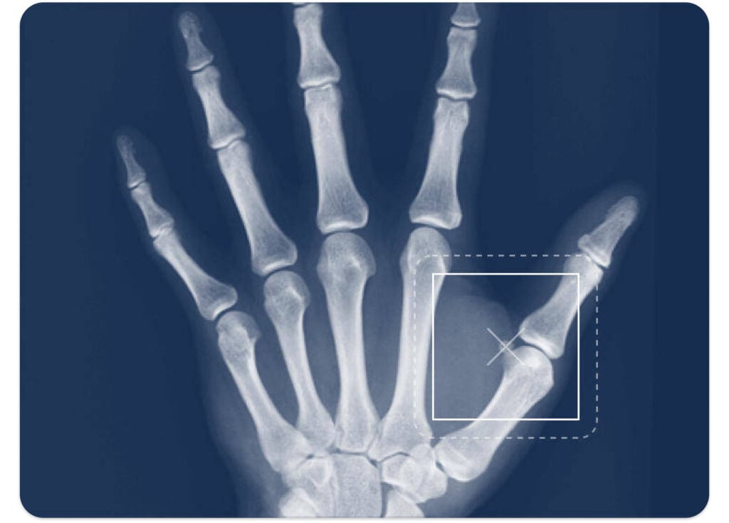Advanced visual AI systems can automatically identify and segment-specific objects within images, such as detecting a tumour in a medical scan or isolating a particular cell type in a biopsy.